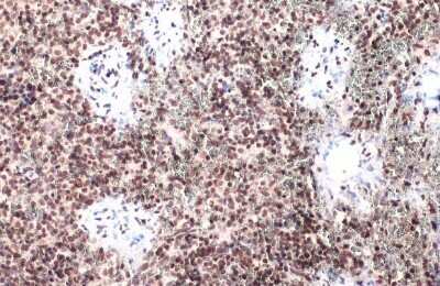Immunohistochemistry-Paraffin: IRF3 [p Ser396] Antibody [NBP3-13379]